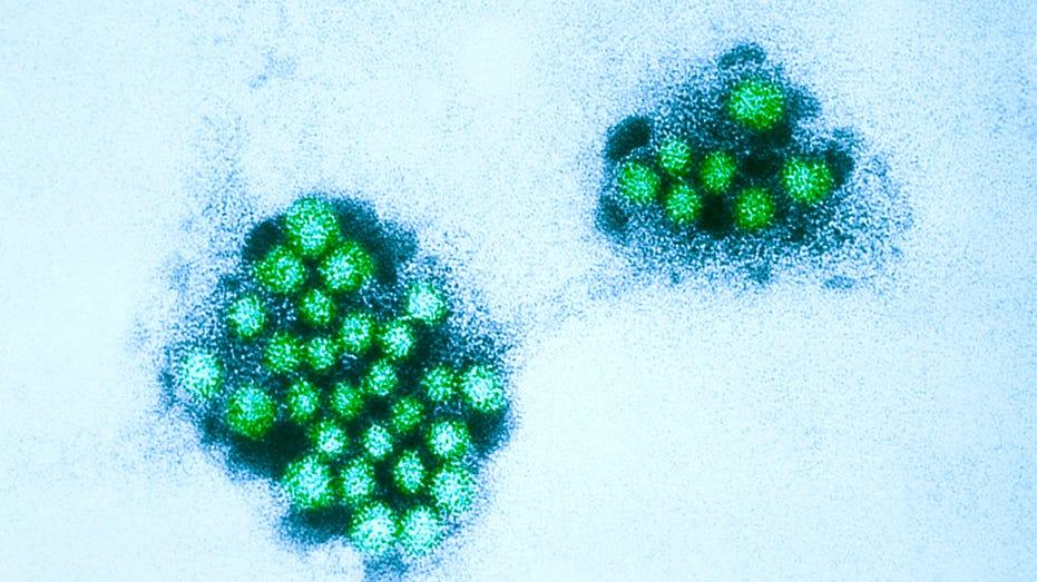 North Texas Middle School Closes Due to Norovirus Outbreak