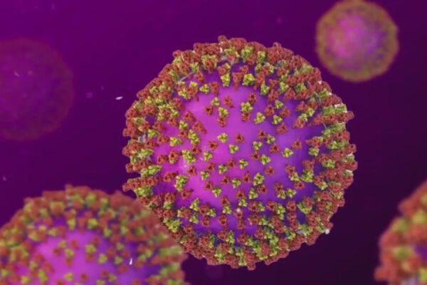 First Measles Case of 2026 Reported in Travis County
